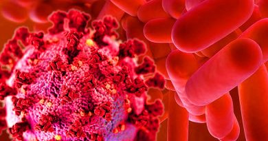 Adveco Advises Taking Legionella Precautions When Reopening Buildings Adveco Advises Taking Legionella Precautions When Reopening Buildings